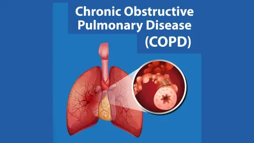 Chronic Obstructive Pulmonary Disease (COPD) Treatment service image