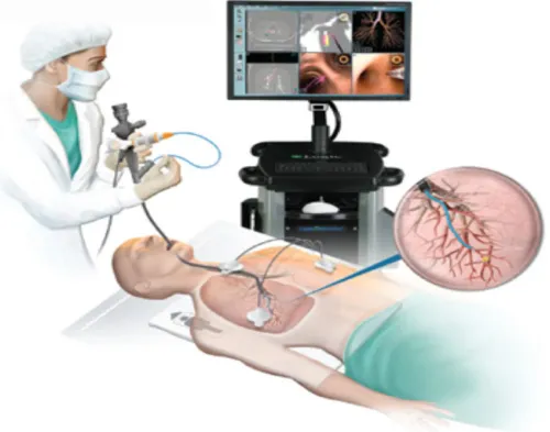 Bronchoscopy Treatment service image