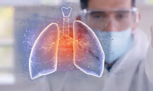 Post-COVID Lung Care & Rehabilitation service image