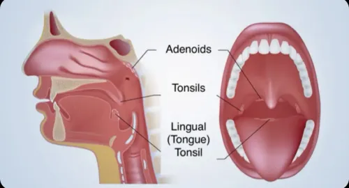 Best Tonsil and Adenoid Surgeon in Bavdhan, Kothrud, Pune, PCMC  service image