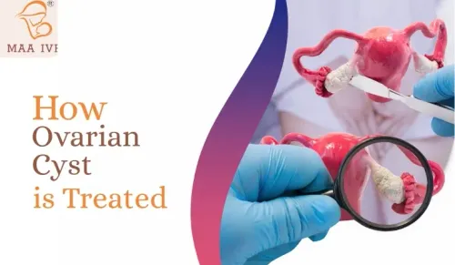 OVARIAN CYST TREATMENT  service image