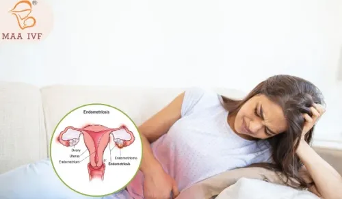 ENDOMETRIOSIS TREATMENT  service image