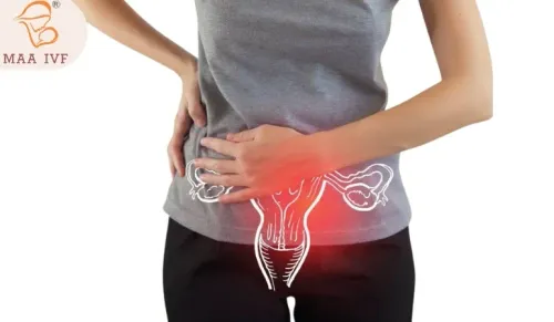 PCOS / PCOD TREATMENT  service image