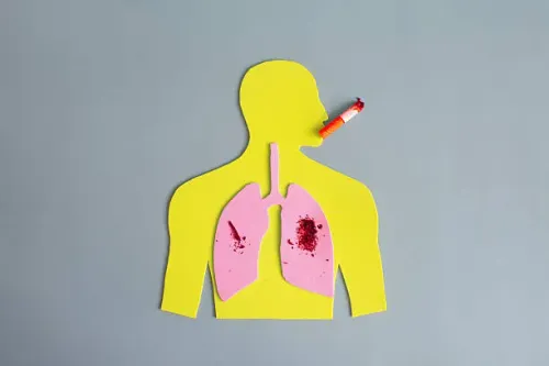 Smoking-Related Lung Disorders service image