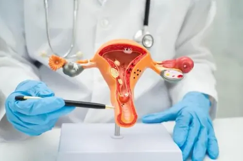 Endometriosis Surgery service image