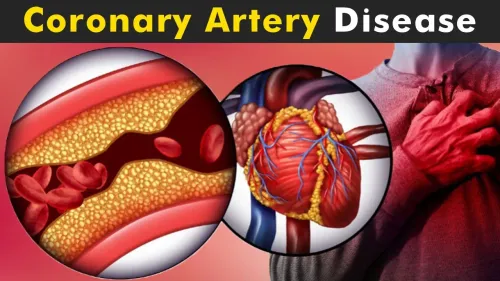 Coronary Artery Disease Treatment service image