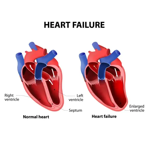 Heart Failure Treatment service image