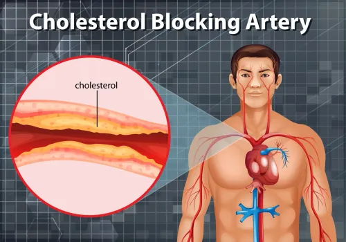 Blocked Arteries Treatment service image