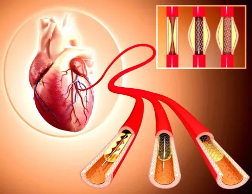 Angiography Treatment service image
