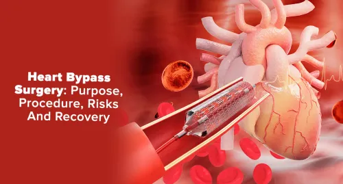 Bypass Surgery (CABG) Treatment service image