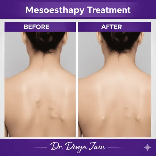 Mesotherapy service image