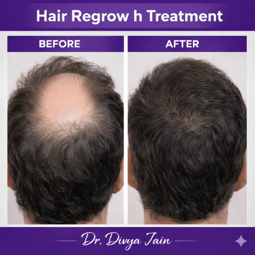 Hair Regrowth service image