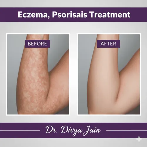 Eczema, Psoriasis service image