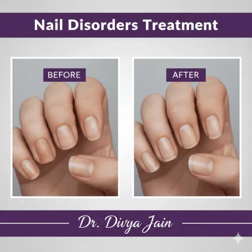 Nail Disorders service image