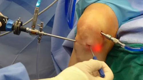 Best Arthroscopy Surgery Hospital in Bibwewadi, Dhankawadi, Market Yard, Kondhwa, Pune service image