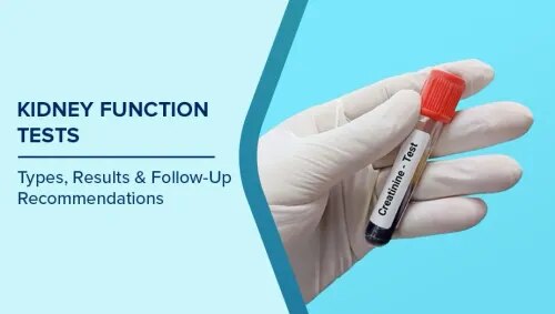 Kidney Function Test (KFT) service image