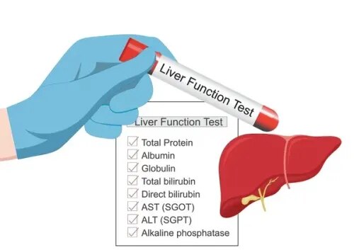 Liver Function Test (LFT) service image
