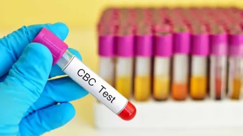 Complete Blood Count (CBC) service image
