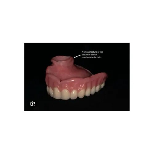 Palatal Obturator  service image