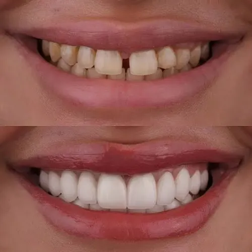 Cosmetic Dentistry service image