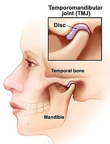 TMJ Treatment service image