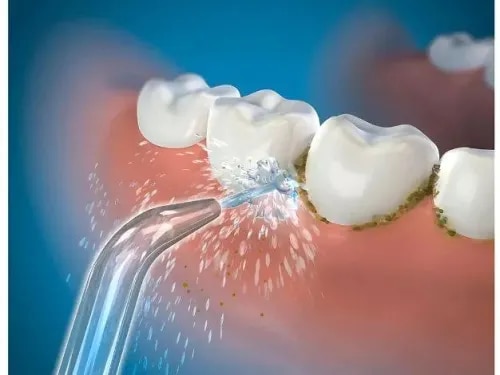 Teeth Cleaning service image