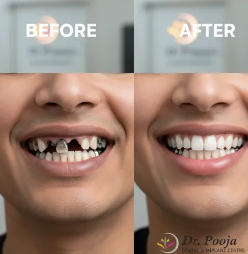 Full Mouth Rehabilitation service image