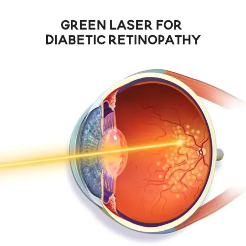 Diabetic Retinopathy Treatment service image