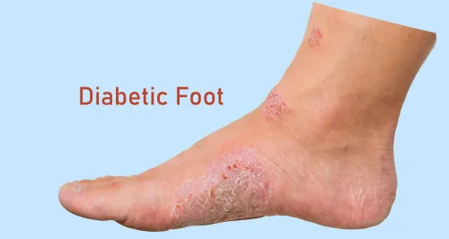 Diabetic Foot Treatment service image