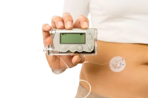 Insulin Pump Therapy service image
