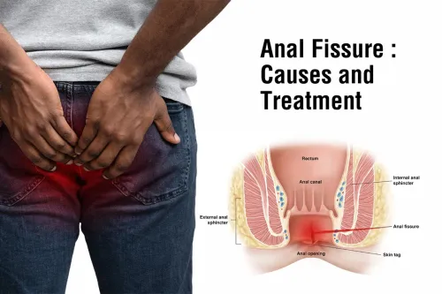  Fissure Treatment service image