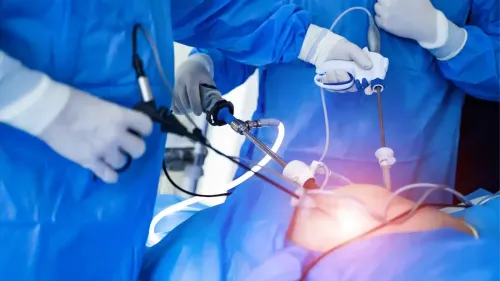 Laparoscopic Hysterectomy Treatment service image