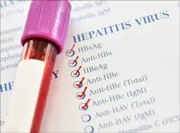 HEPATITIS MARKERS service image