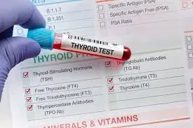 THYROID TESTING service image