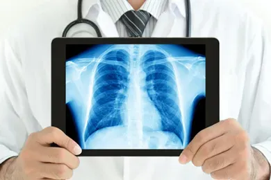 DIGITAL X-RAY service image