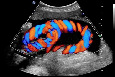 COLOR DOPPLER service image