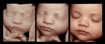 ULTRASOUND service image