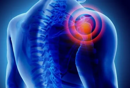 Shoulder Fracture Treatment service image