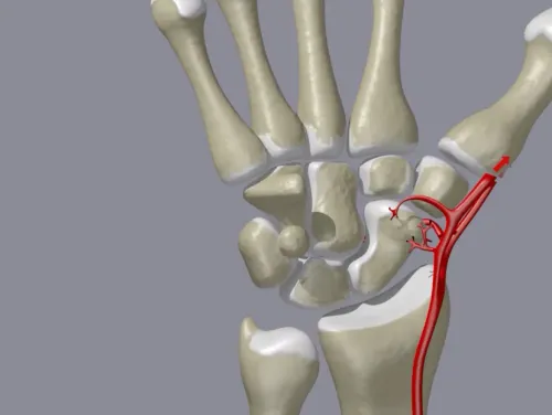 Scaphoid Fracture Treatment service image