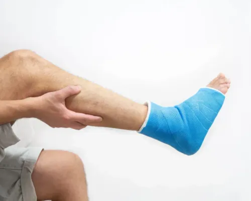 Leg Fracture Treatment service image