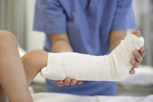 Fracture Treatment service image