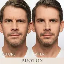 Bro-tox  service image
