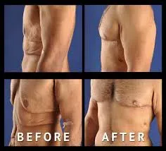 Weight Loss Surgery  service image
