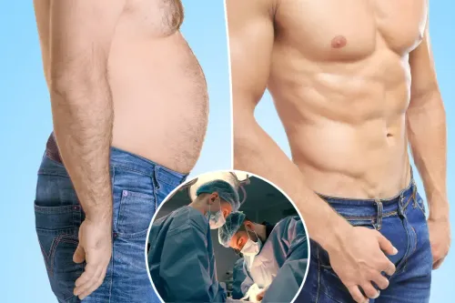 6 Pack Creation Surgery service image