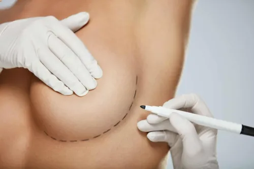 Constricted Breast Treatment service image