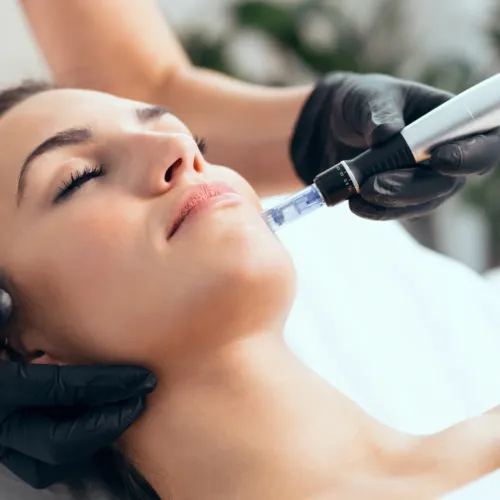 Mesotherapy Treatment service image