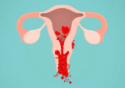 Menstrual Disorders Management service image