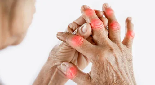 Arthritis/Joint Related Disease service image