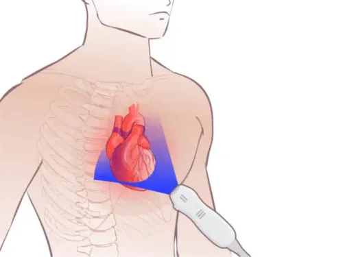 2D Echocardiography & Doppler Study service image
