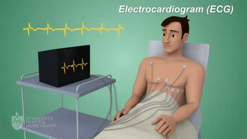 ECG (Electrocardiogram) service image